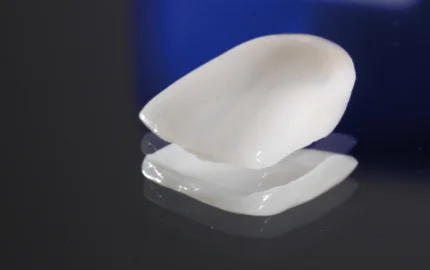 Diş Beyazlatma Yöntemleri ve Faydaları